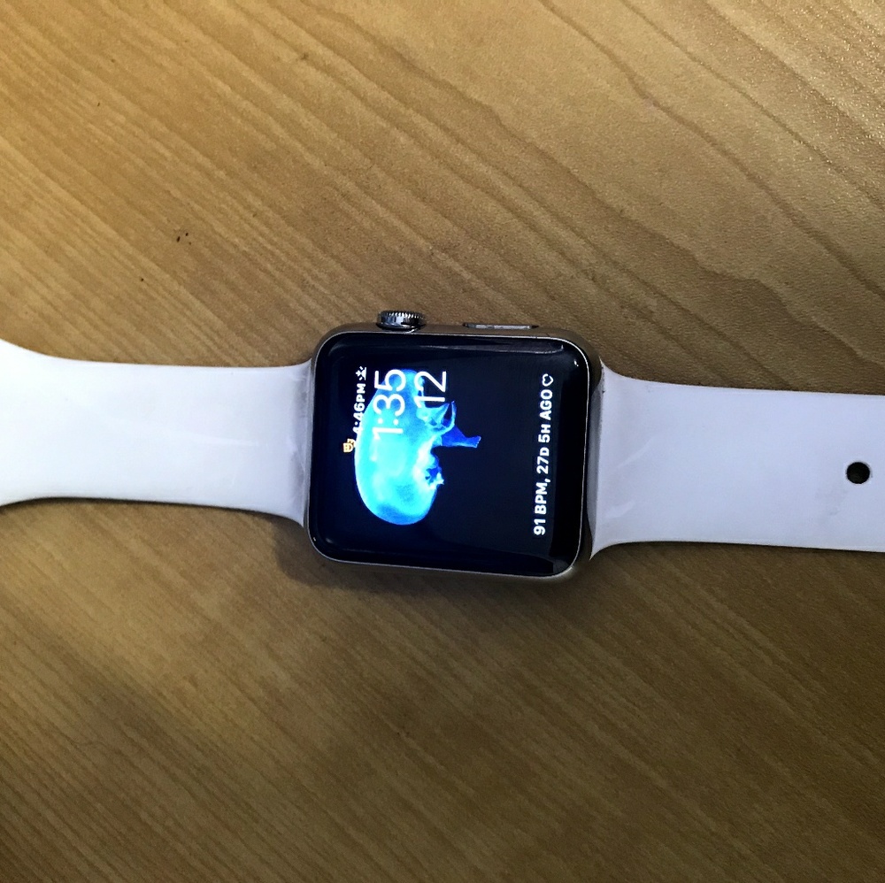 Apple watch series 1